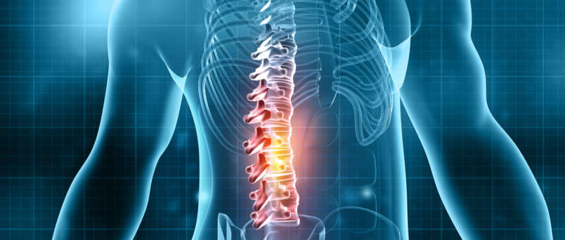 Conditions - Prestige Spine - Interventional Pain Management